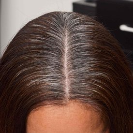 Color Gels Oil Roots Before